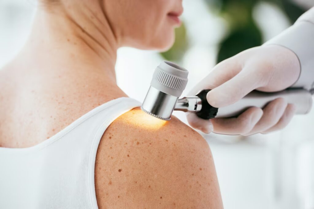 Consultar-um-dermatologista-é-sempre-válido Consultar-um-dermatologista-é-sempre-válido